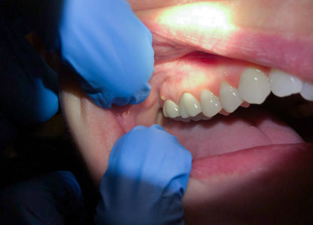 Best Broken Tooth Emergency  in Troy, MO